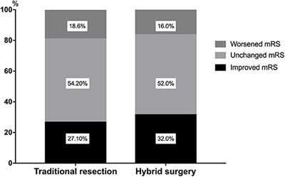 Single-Stage Combined Embolization and Resection for Spetzler-Martin Grade III/IV/V Arteriovenous Malformations: A Single-Center Experience and Literature Review